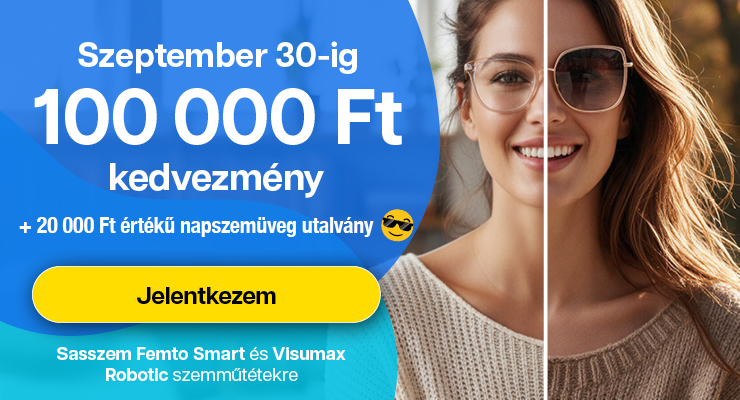 Sasszem FEMTO Smart 200.000 Ft kedvezmény