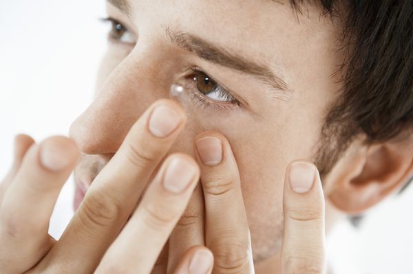 Allergiát okozhat a kontaktlencse és kontaktlencse-problémát az allergia
