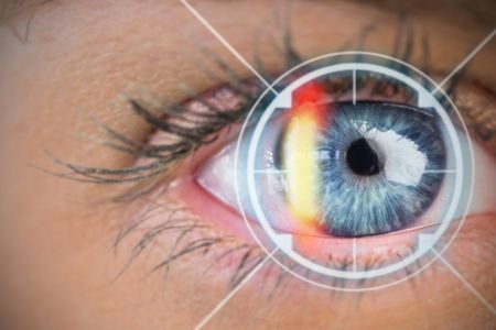 5 különböző módszerrel is megmérjük szemeinek fénytörési hibáit